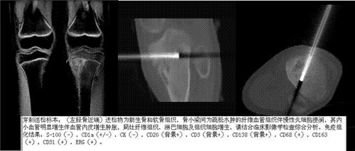 新澳门期期精准准确,安全解析方案_CT95.851