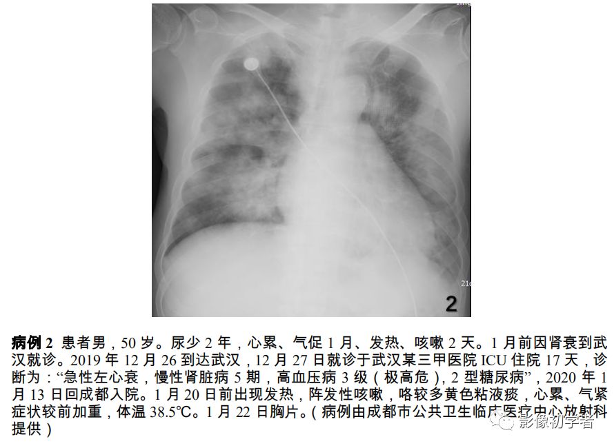 全球新型冠状肺炎动态更新与应对策略综述